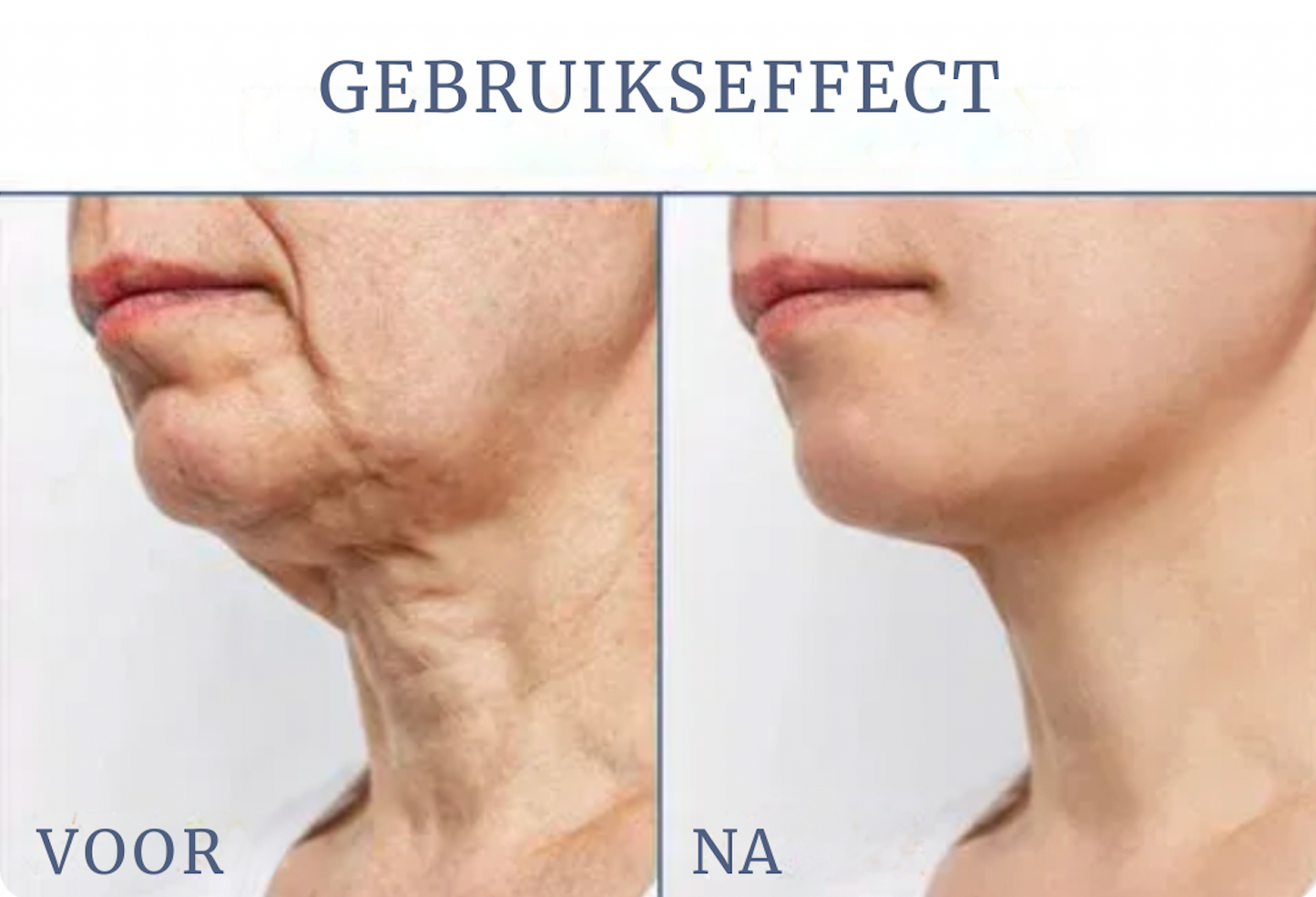 FIRMOZE™|Verstevigende & Rimpel.verminderende Crème
