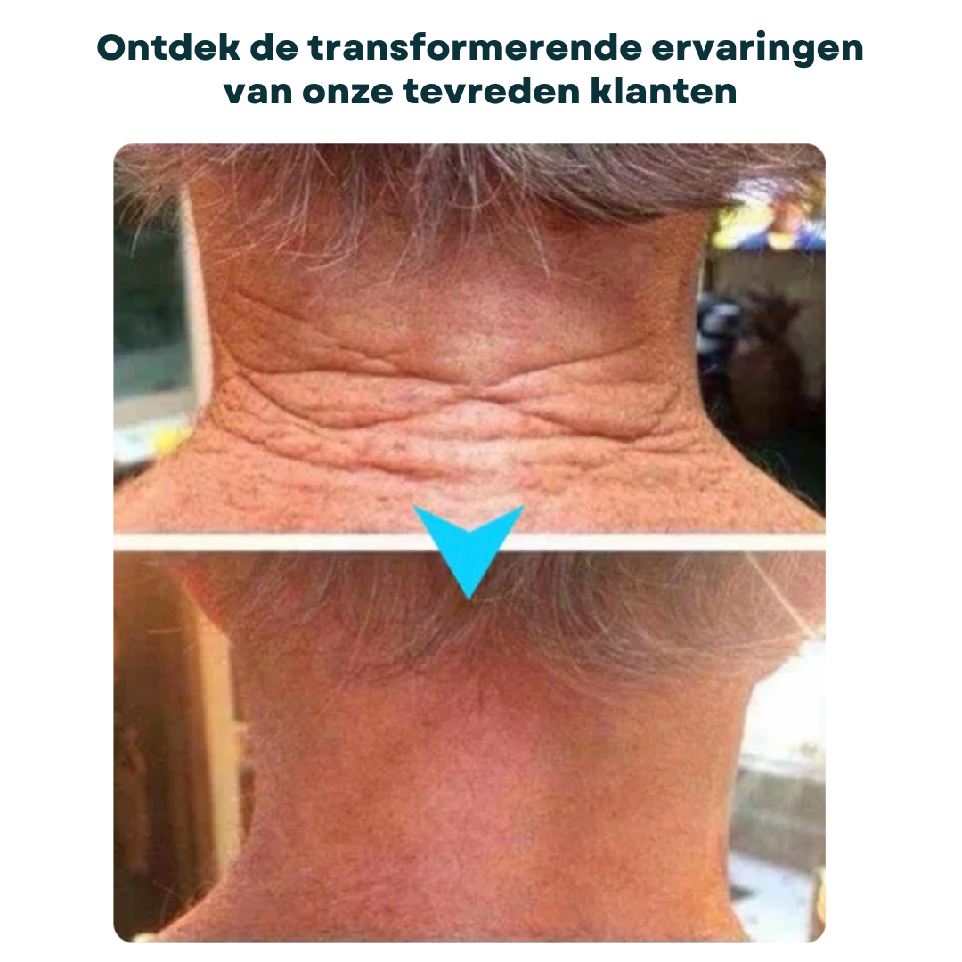 FIRMOZE™|Verstevigende & Rimpel.verminderende Crème