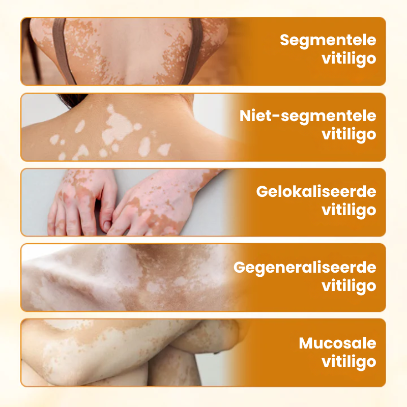 EVYNTONA™|Huidpigmentatie Crème