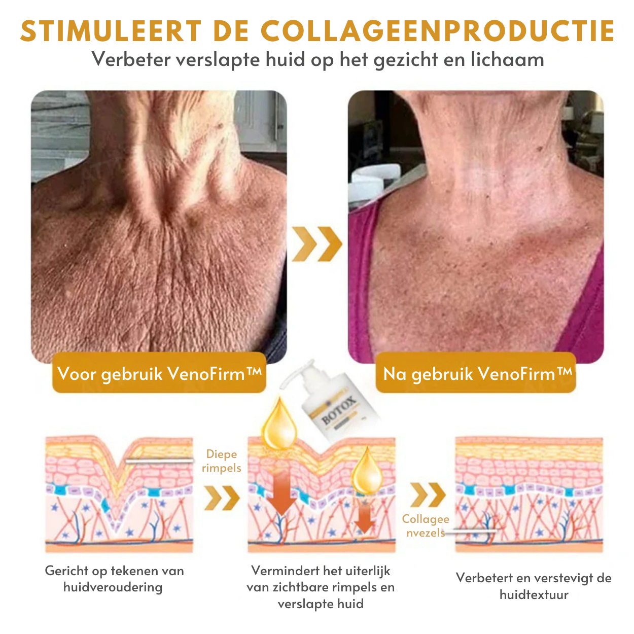 Botox™丨Rimpelverstevigende Crème