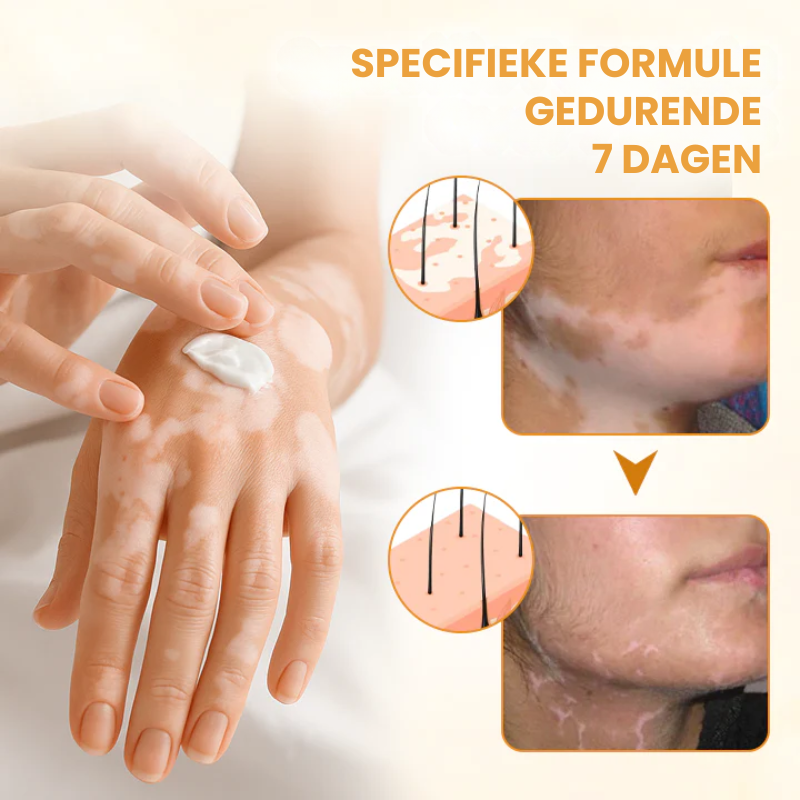 EVYNTONA™|Huidpigmentatie Crème