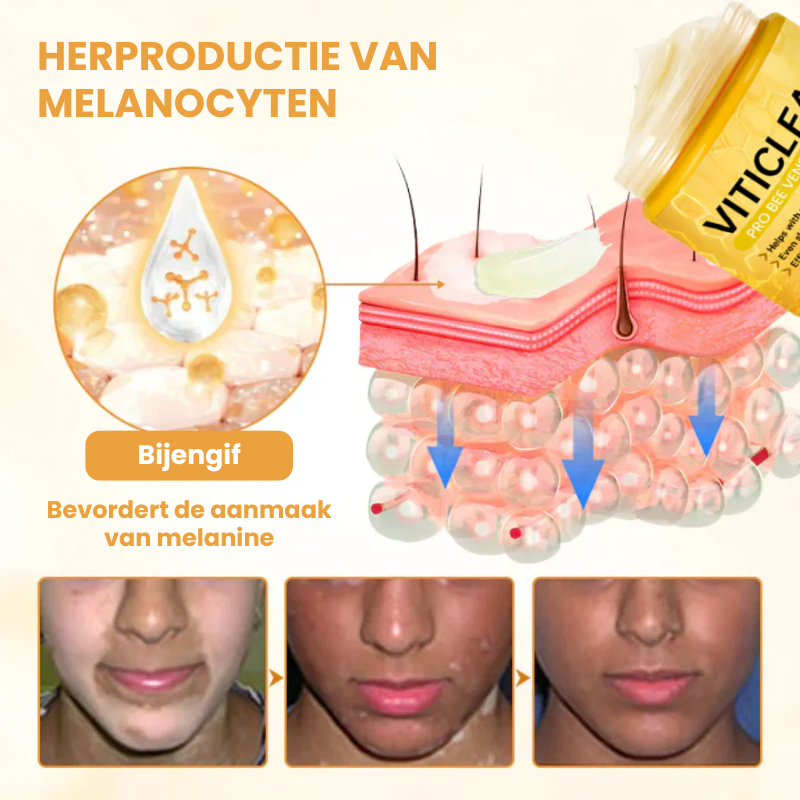 EVYNTONA™|Huidpigmentatie Crème