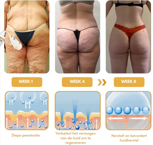 Botox™丨Rimpelverstevigende Crème
