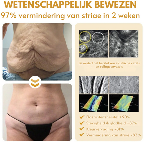 Botox™丨Rimpelverstevigende Crème