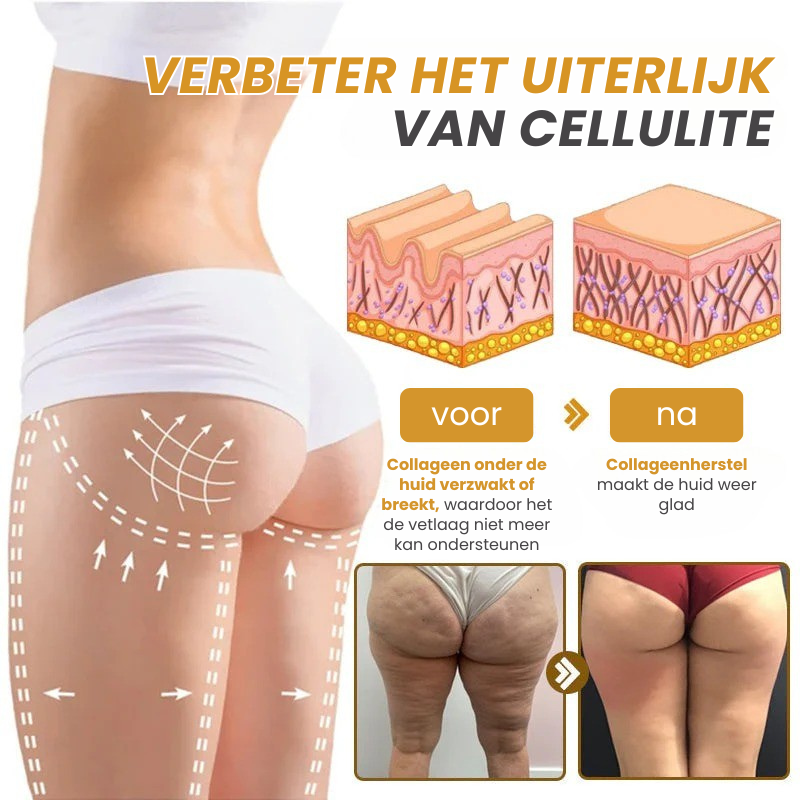 Botox™丨Rimpelverstevigende Crème