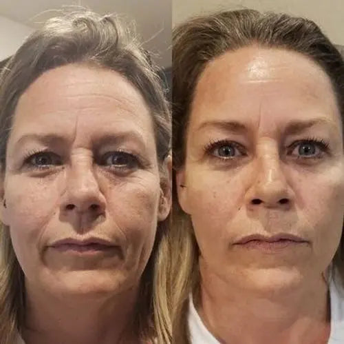 FIRMOZE™|Verstevigende & Rimpel.verminderende Crème