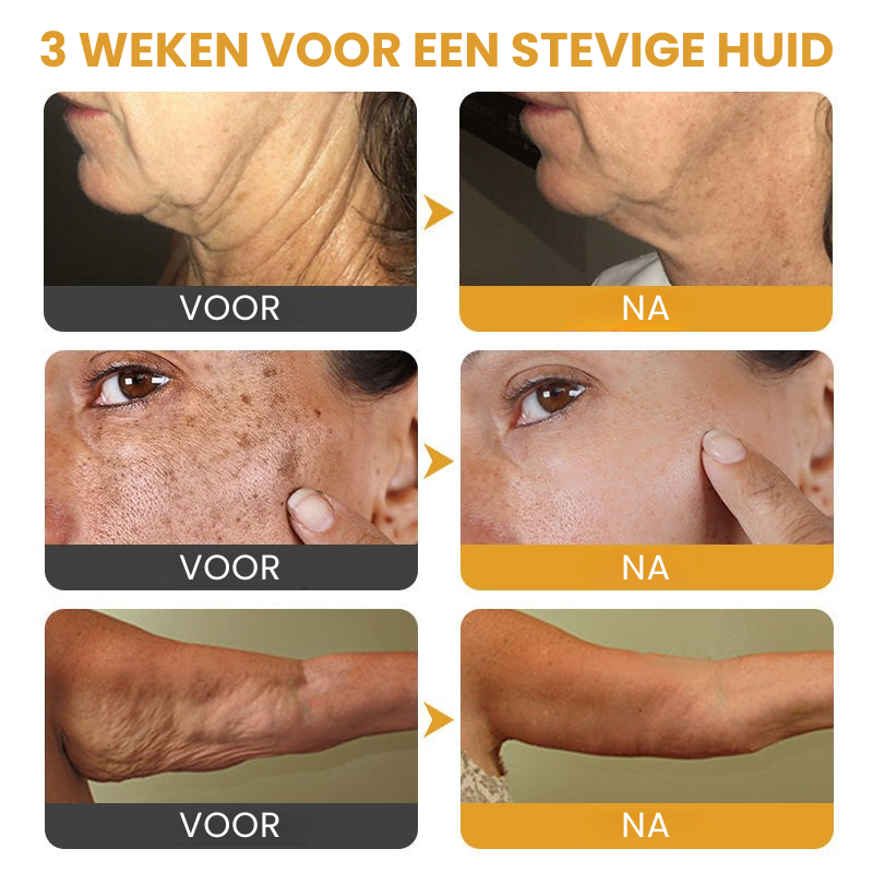 Botox™丨Rimpelverstevigende Crème