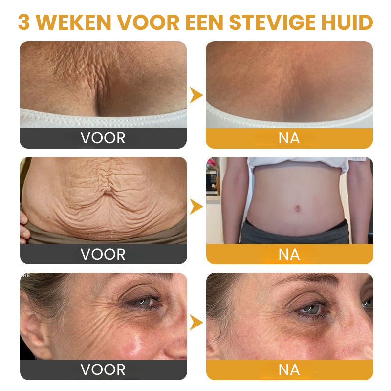 Botox™丨Rimpelverstevigende Crème