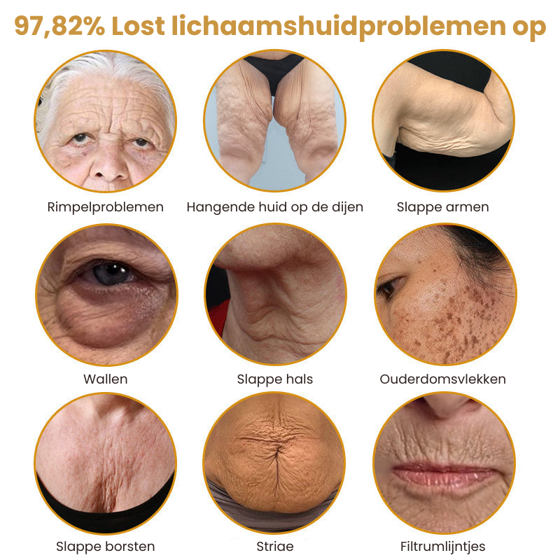 Botox™丨Rimpelverstevigende Crème