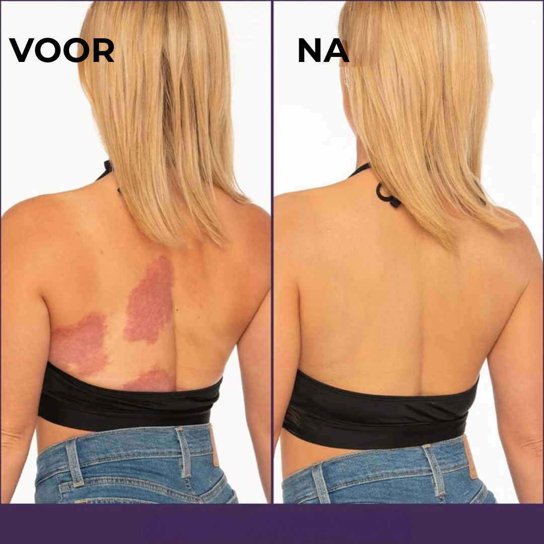 Multifunctionele Lichaamsbeschermer