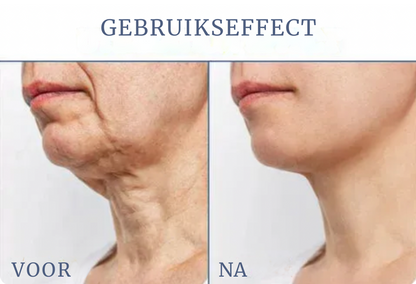 FIRMOZE™|Verstevigende & Rimpel.verminderende Crème