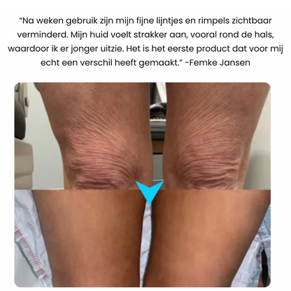 FIRMOZE™|Verstevigende & Rimpel.verminderende Crème