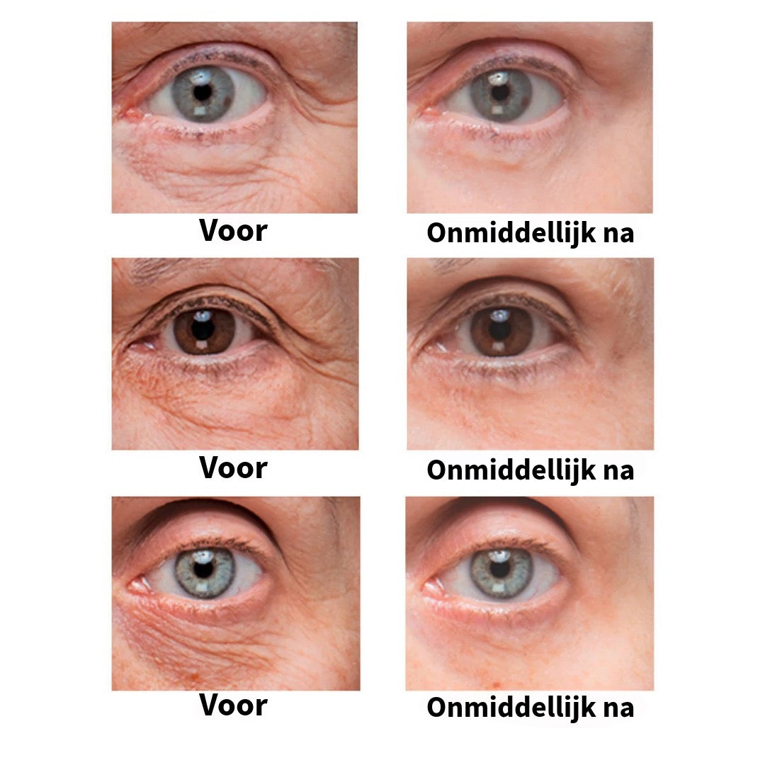 BrightUp™ – Elimineert wallen & rimpels