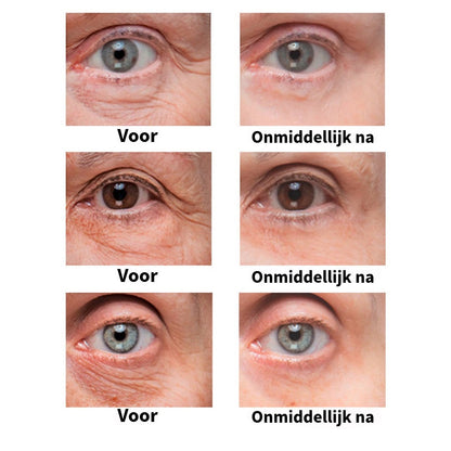 BrightUp™ – Elimineert wallen & rimpels