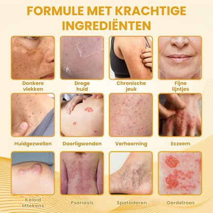 DERMCLYR™ l Antibacteriële Huidherstelgel
