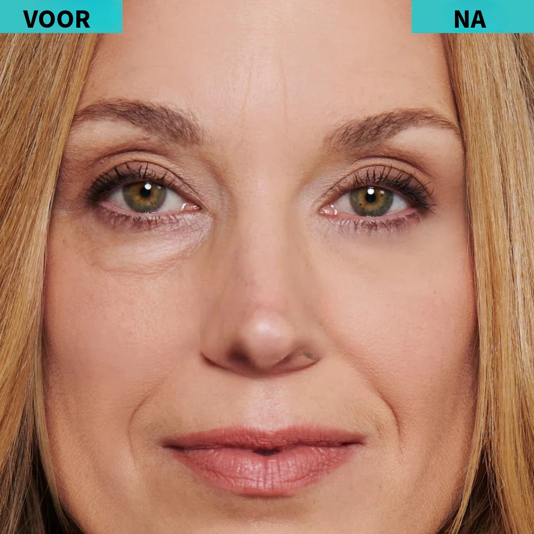 BrightUp™ – Elimineert wallen & rimpels