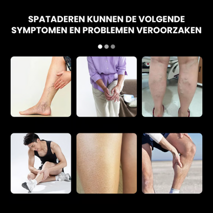 VaricoLicht™ |Spatader spray