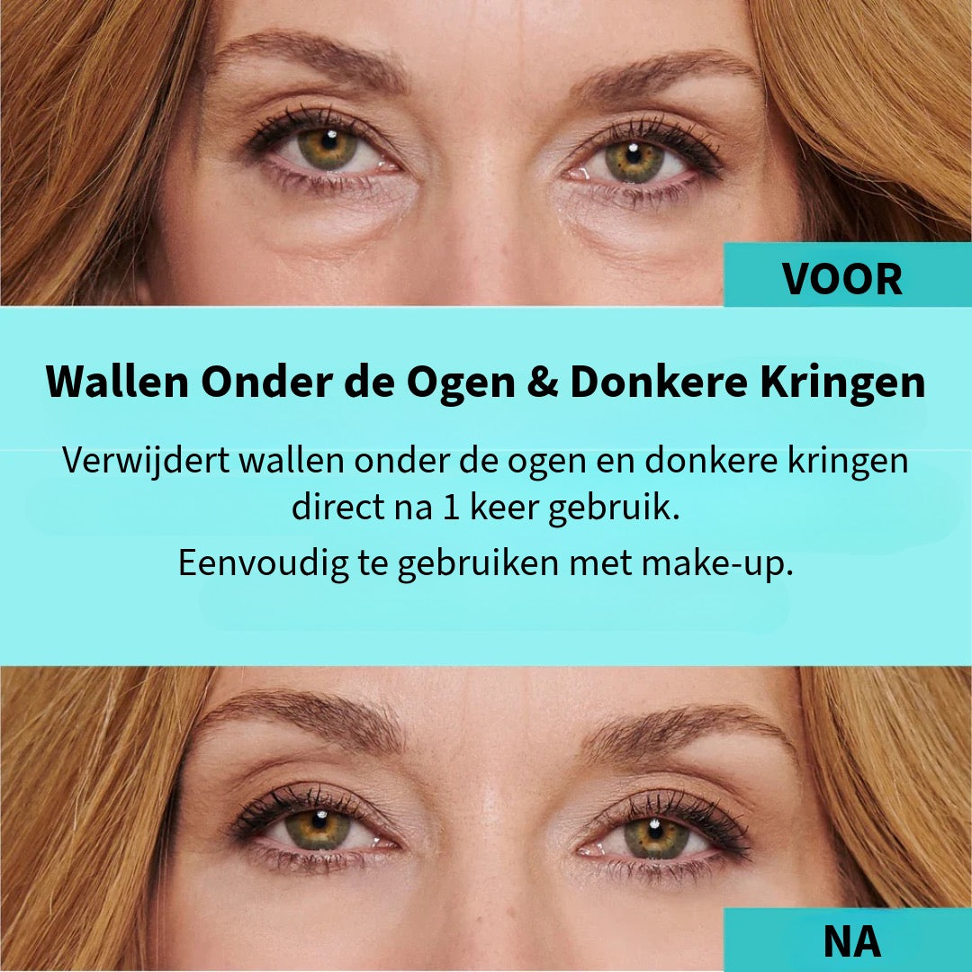 BrightUp™ – Elimineert wallen & rimpels