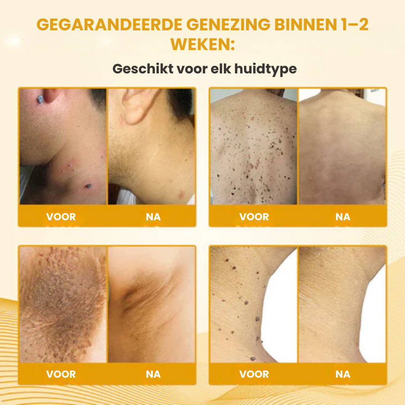 DERMCLYR™ l Antibacteriële Huidherstelgel