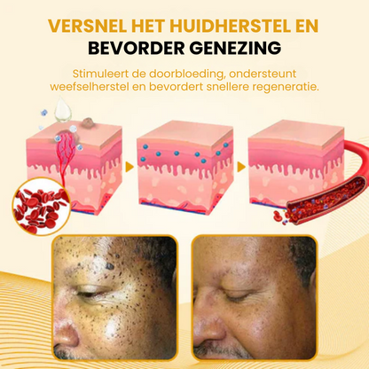 DERMCLYR™ l Antibacteriële Huidherstelgel