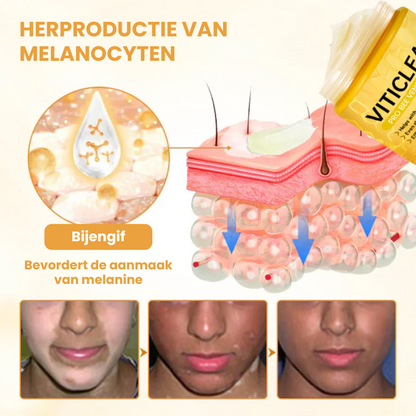 EVYNTONA™|Huidpigmentatie Crème