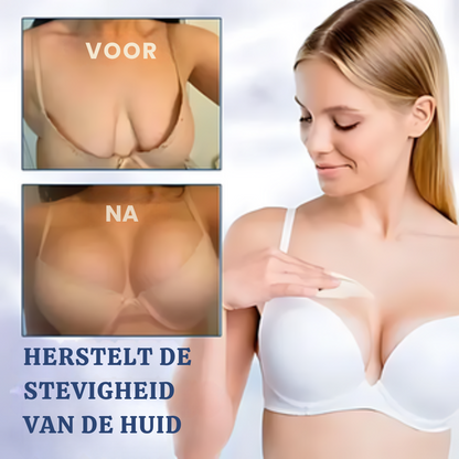 FIRMOZE™|Verstevigende & Rimpel.verminderende Crème