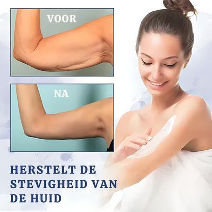 FIRMOZE™|Verstevigende & Rimpel.verminderende Crème