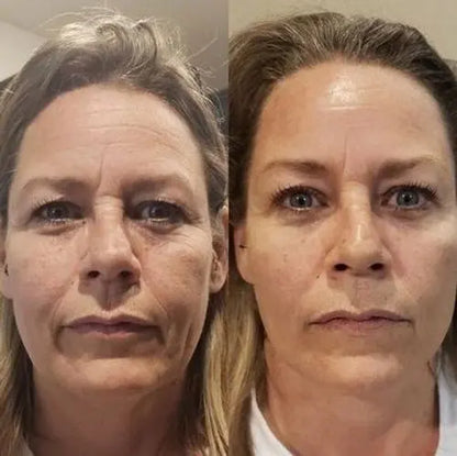 FIRMOZE™|Verstevigende & Rimpel.verminderende Crème
