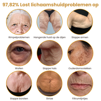 Botox™丨Rimpelverstevigende Crème