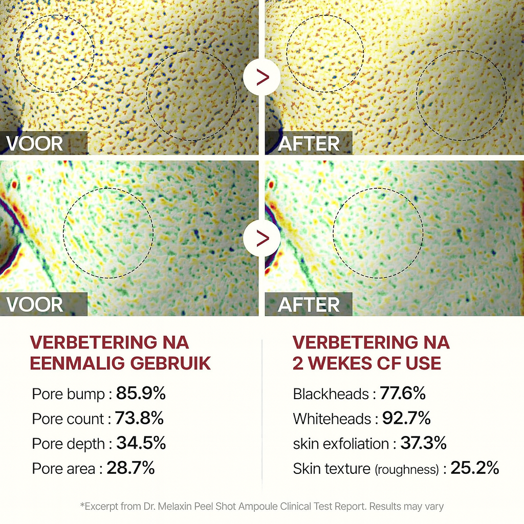 Radiant Glow Rijstpeeling Ampul™