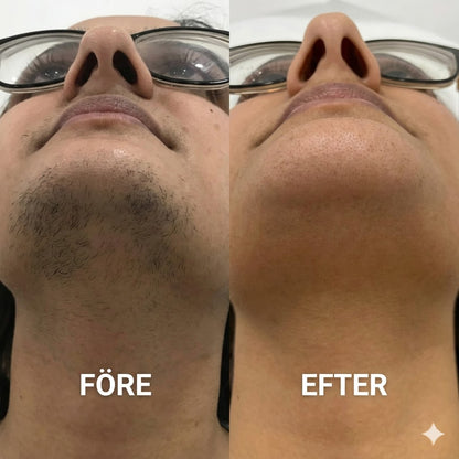 Mjuk Och Smärtfri Kräm För Borttagning Av Ansiktshår