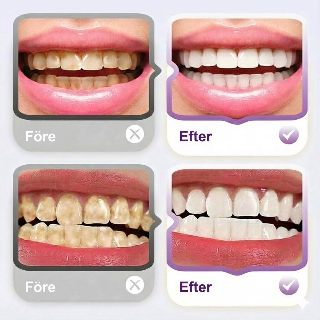 Lysozyme Uppljusande Fläckborttagningstandkräm