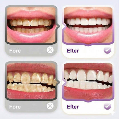 Lysozyme Uppljusande Fläckborttagningstandkräm