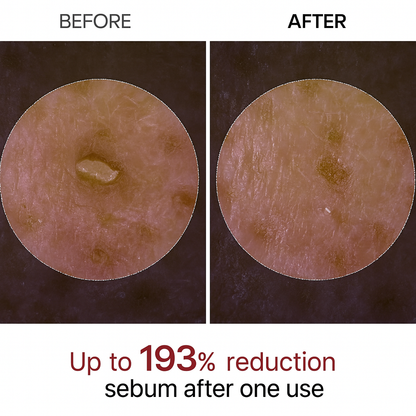 Radiant Glow Rijstpeeling Ampul™