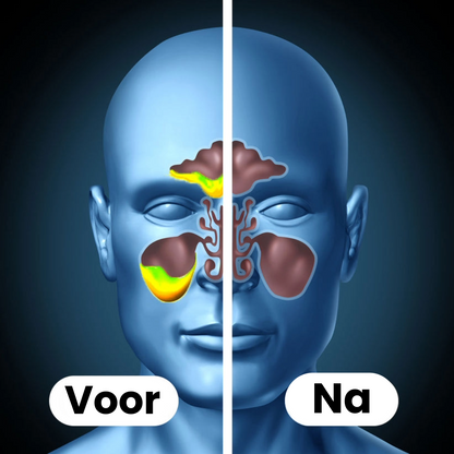 Frisse Neus Sinusreiniger
